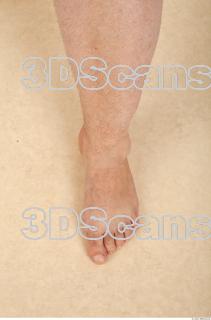 Photo reference of foot 0001